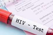 چه کسانی باید آزمایش ایدز بدهند؟