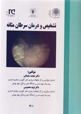 تشخیص و درمان سرطان مثانه 