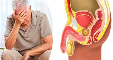 دستیابی به راهکار جدید در طراحی سلول‌های هوشمند برای درمان هدفمند سرطان پروستات