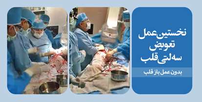 برای نخستین بار، تعویض دریچه سه لتی قلب بدون نیاز به جراحی باز انجام شد