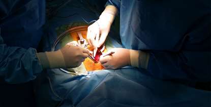 دوره آموزشی روش های جدید جراحی با تهاجم اندک در زمینه جراحی قفسه سینه برگزار می شود