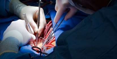 انجام موفقیت آمیز عمل جراحی دایسکشن آئورت در بیمارستان شهید مدرس