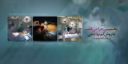 نخستین جراحی قلب به روش کم تهاجمی Minimally Invasive در دانشگاه انجام شد 