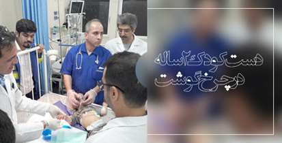 دست کودک 2 ساله در چرخ گوشت/ تیم درمانی بیمارستان امام حسین به موقع وارد عمل شدند