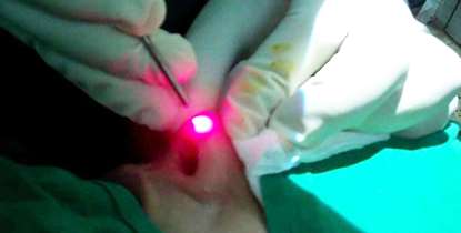 دومین سمینار کاربرد لیزر در اورولوژی برگزار شد/برتری ایران در ساخت دستگاه های لیزر درمانی