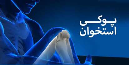 روز جهانی پوکی استخوان/"استخوان های خود را دوست بداریم و از آینده خود محافظت کنیم"