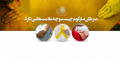 پیشگیری، علایم و درمان سرطان سارکوم/ بیش از 70 نوع سرطان سارکوم، سلامت بشر را تهدید می کند