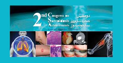 بررسی تازه ترین راه های تشخیص و درمان در دومین کنگره «تازه های سارکوئیدوز» 