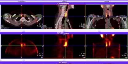 کنفرانس علمی تشخیص انواع تیروئید ها در بیمارستان شهدای تجریش برگزار شد