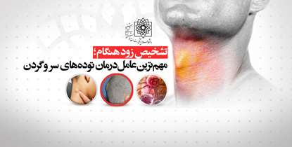 عضو هیئت علمی دانشگاه: تشخیص زودهنگام مهم ترین عامل درمان توده های سر و گردن است