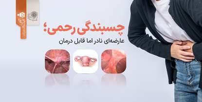 آگاهی کلید سلامت زنان/ چسبندگی رحمی، عارضه‌ای نادر اما قابل درمان 
