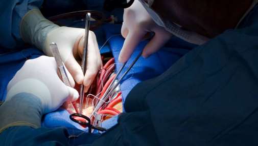 جراحی قلب باز در بیمارستان مدرس