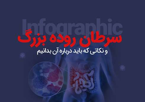 سرطان روده بزرگ و نکاتی که باید درباره آن بدانیم